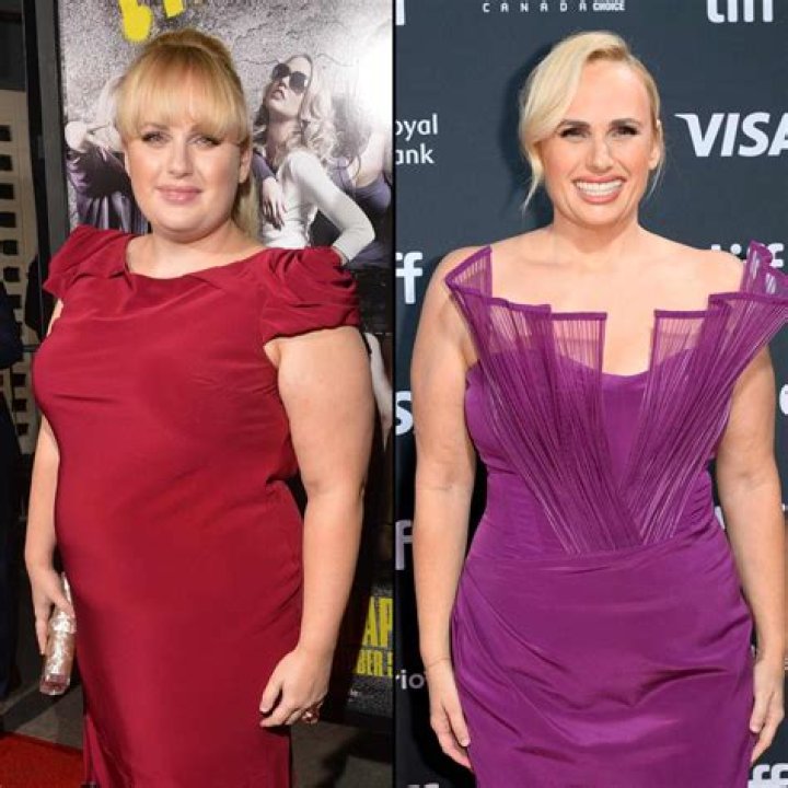 10 celebrities who have undergone weight loss surgery