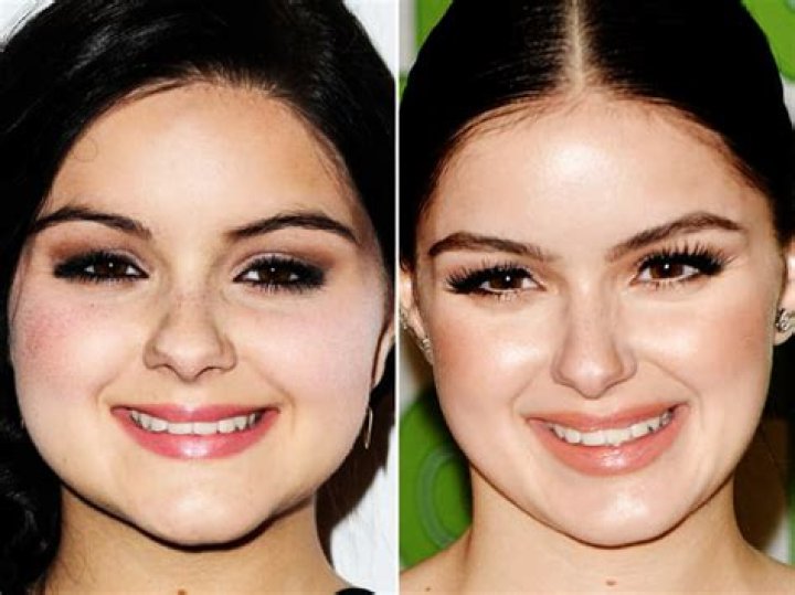 Ariel Winter Plastic Surgery Before and After