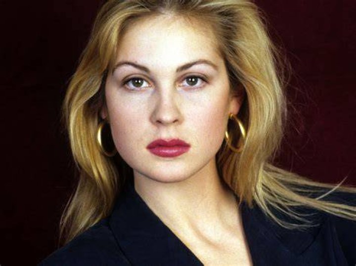 Kelly Rutherford Plastic Surgery Before and After