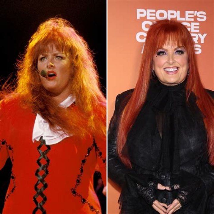 Naomi Judd plastic surgery before and after photos