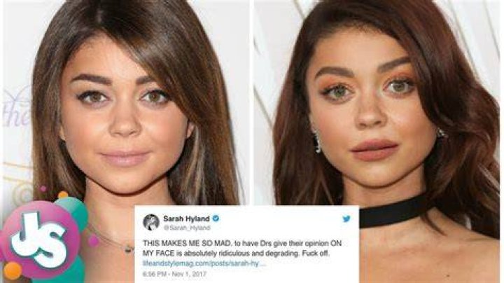sarah hyland plastic surgery