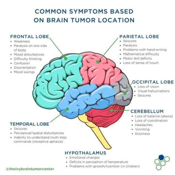 What disease did Tom Parker have? Brain tumor explained