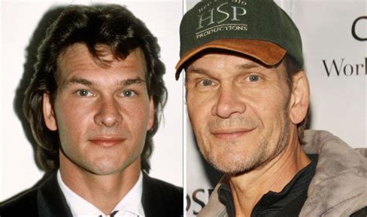 What disease does Patrick Swayze have?